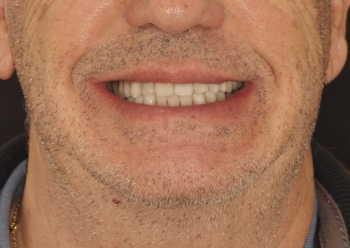 final-odontologia-estetica