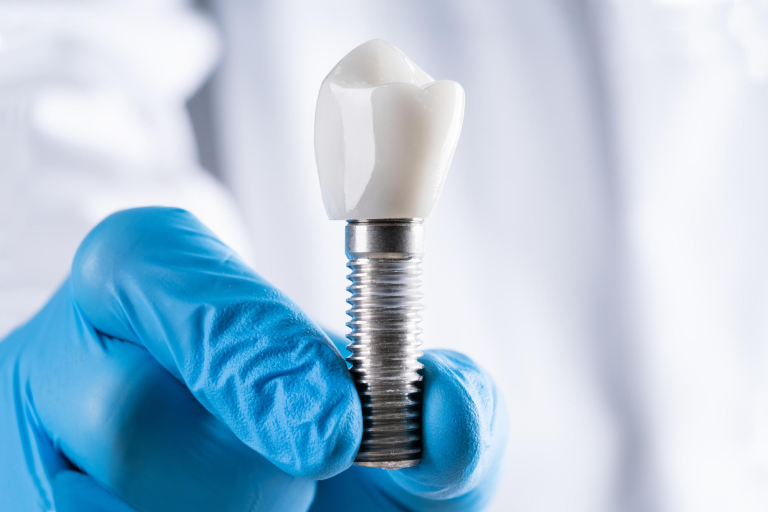 implante dental procedimiento