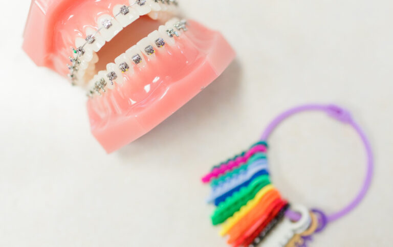 gomas de los brackets